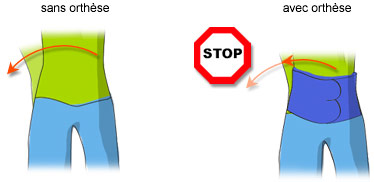 Ceinture lombaire avec et sans orthèse