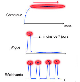 trois types de lombalgies communes