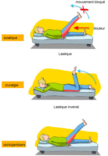 la manoeuvre de Lasègue