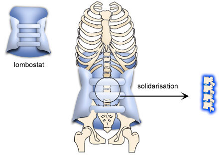 L'intérêt de la ceinture lombaire pour le mal de dos et comment la