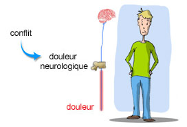 Mécanisme de la douleur neurologique