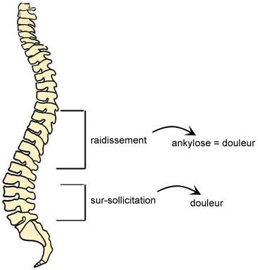 raidissement
