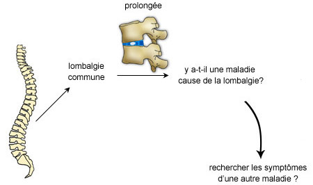 Recherche des symptomes de la lombalgie commune