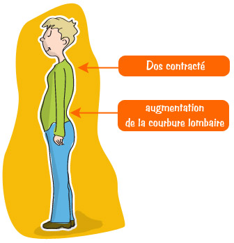 Raidissement à l'effort - Lombalgie